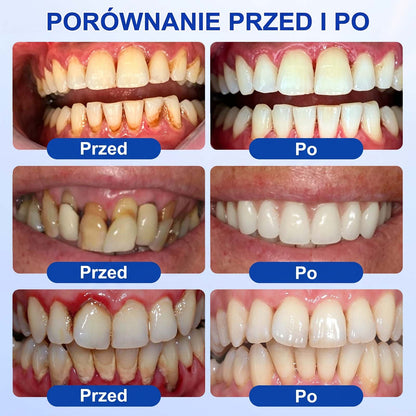 Evolvion® 👩‍⚕️ GumRevive – Zaawansowany żel do pielęgnacji dziąseł, wspierający ich zdrowy i mocny wygląd💎