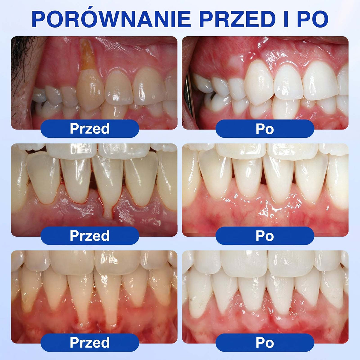 Evolvion® 👩‍⚕️ GumRevive – Zaawansowany żel do pielęgnacji dziąseł, wspierający ich zdrowy i mocny wygląd💎