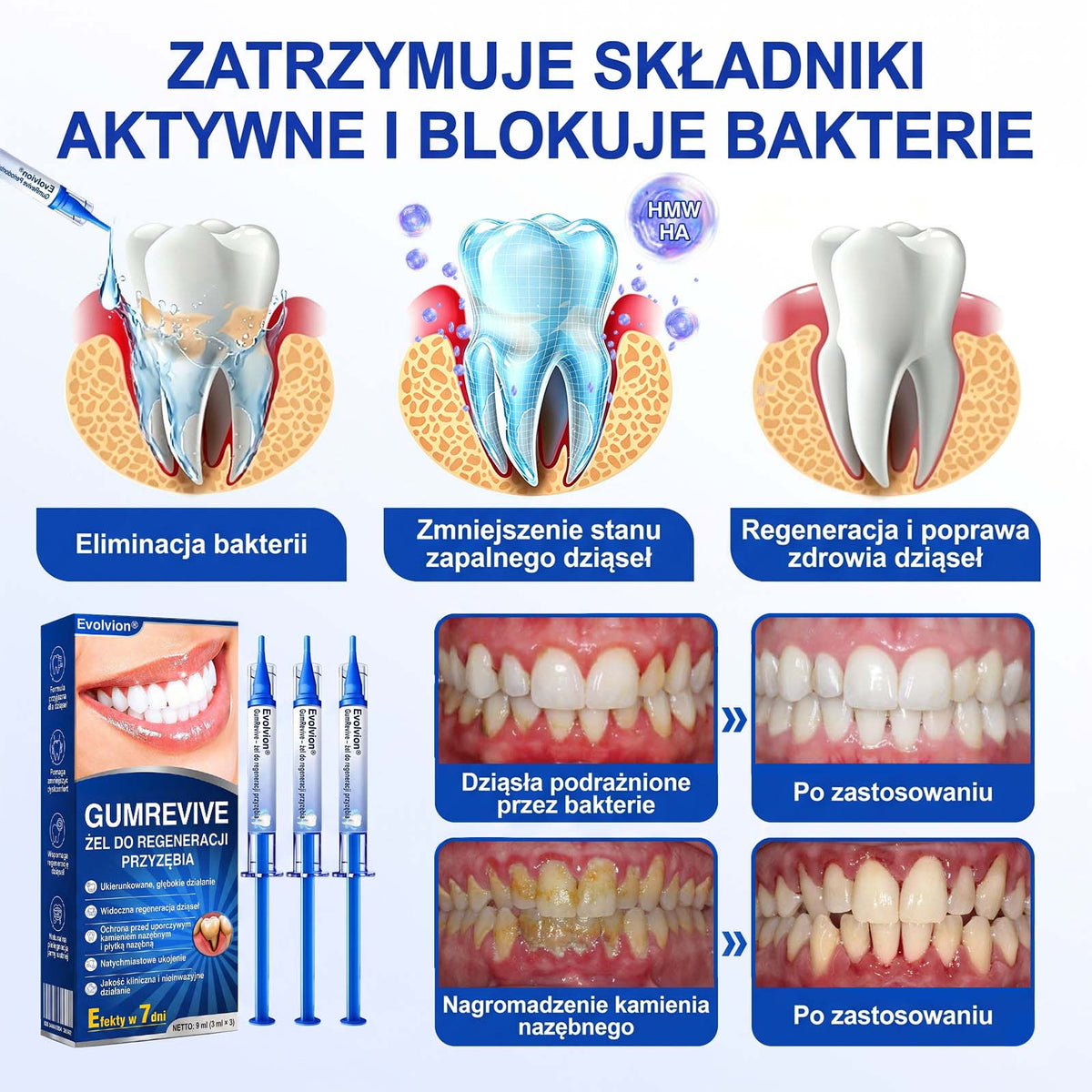 Evolvion® 👩‍⚕️ GumRevive – Zaawansowany żel do pielęgnacji dziąseł, wspierający ich zdrowy i mocny wygląd💎