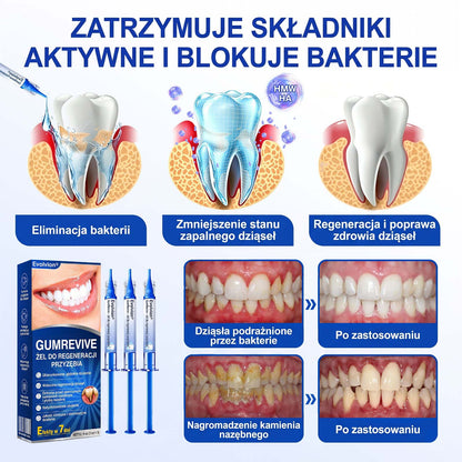Evolvion® 👩‍⚕️ GumRevive – Zaawansowany żel do pielęgnacji dziąseł, wspierający ich zdrowy i mocny wygląd💎