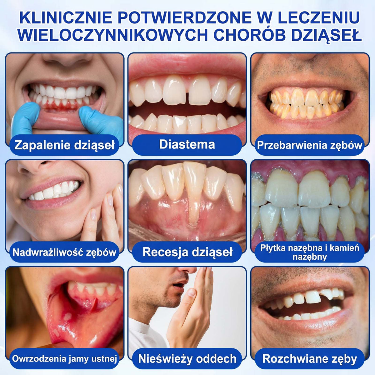 Evolvion® 👩‍⚕️ GumRevive – Zaawansowany żel do pielęgnacji dziąseł, wspierający ich zdrowy i mocny wygląd💎