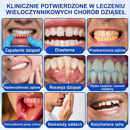 Evolvion® 👩‍⚕️ GumRevive – Zaawansowany żel do pielęgnacji dziąseł, wspierający ich zdrowy i mocny wygląd💎