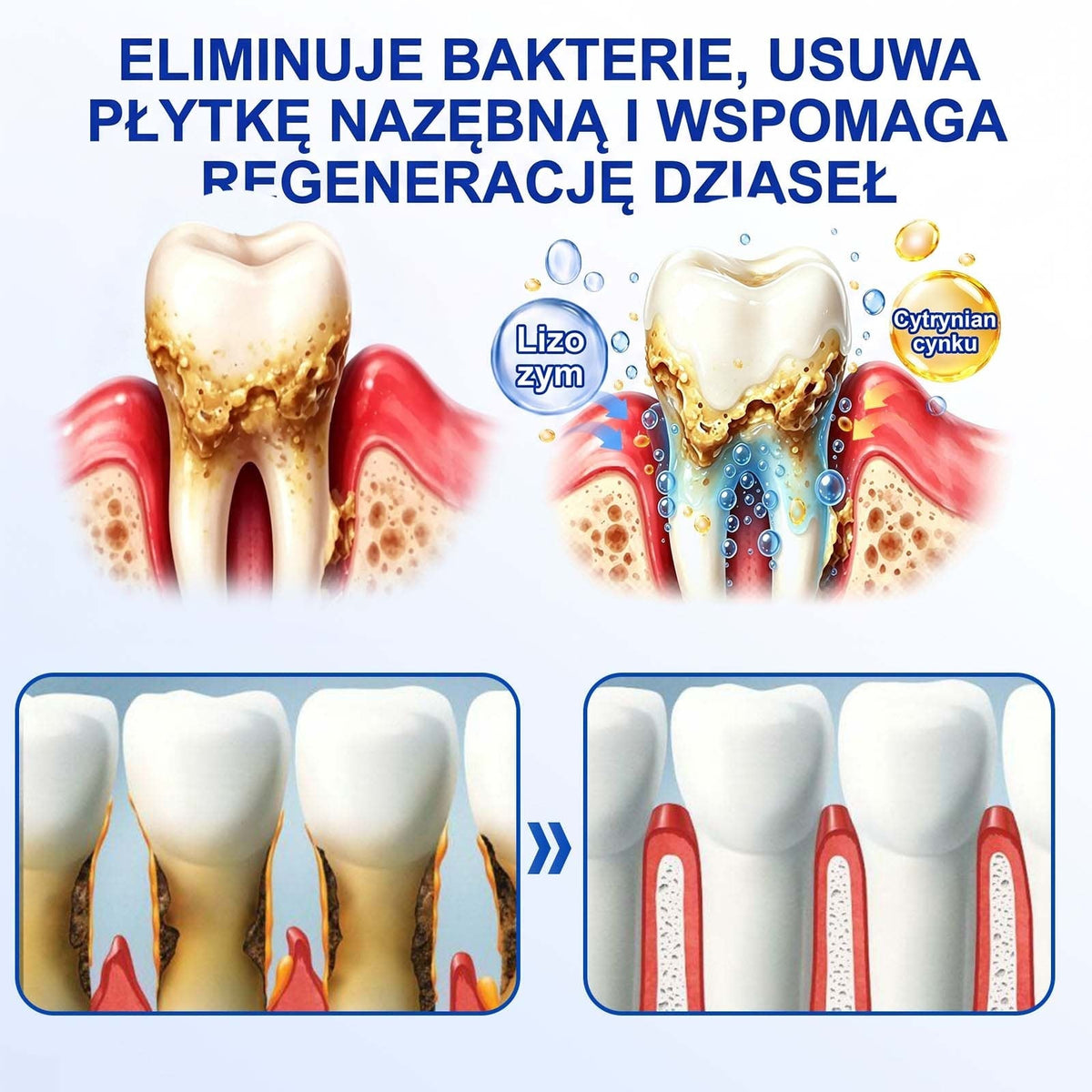 Evolvion® 👩‍⚕️ GumRevive – Zaawansowany żel do pielęgnacji dziąseł, wspierający ich zdrowy i mocny wygląd💎