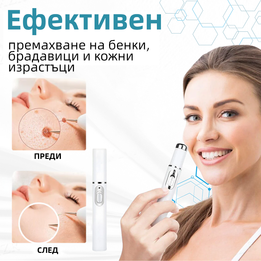 Kidsneed® Невъздействащ лазерен молив за премахване на бенки и брадавици – Висококачествен🍀