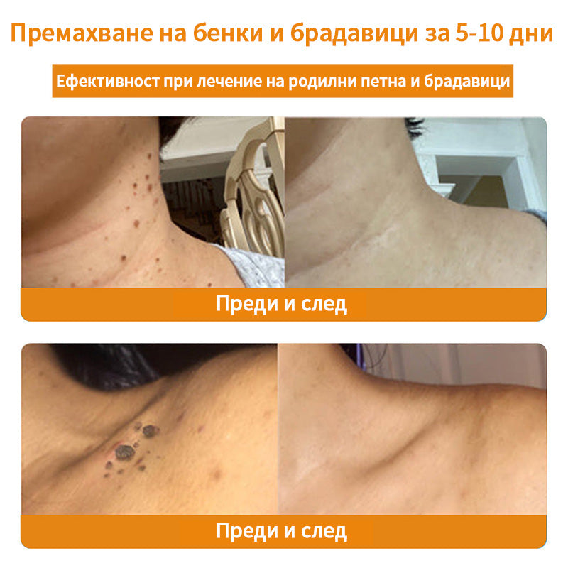 𝑇𝑢𝑟𝑜𝑛𝑢™ Крем за грижа за кожата на основата на пчелна отрова🐝 (Препоръчано от NCPH)💎