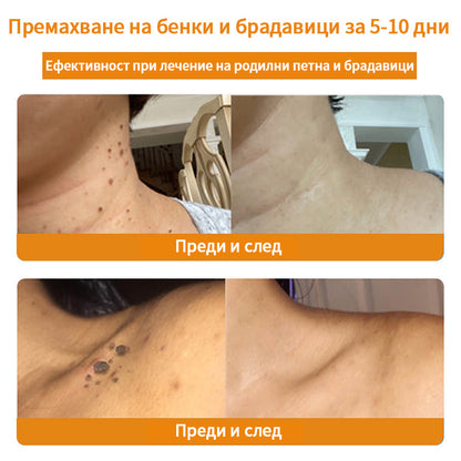 𝑇𝑢𝑟𝑜𝑛𝑢™ Крем за грижа за кожата на основата на пчелна отрова🐝 (Препоръчано от NCPH)💎