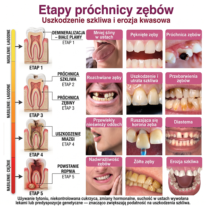 Rolimey® DenPerm – Naturalny żel wypełniający szkliwo do leczenia ubytków próchnicowych🧋