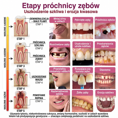 Rolimey® DenPerm – Naturalny żel wypełniający szkliwo do leczenia ubytków próchnicowych🧋