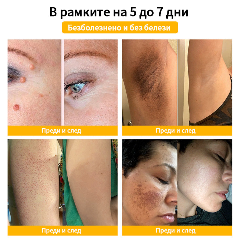 𝑇𝑢𝑟𝑜𝑛𝑢™ Крем за грижа за кожата на основата на пчелна отрова🐝 (Препоръчано от NCPH)💎