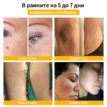 𝑇𝑢𝑟𝑜𝑛𝑢™ Крем за грижа за кожата на основата на пчелна отрова🐝 (Препоръчано от NCPH)💎