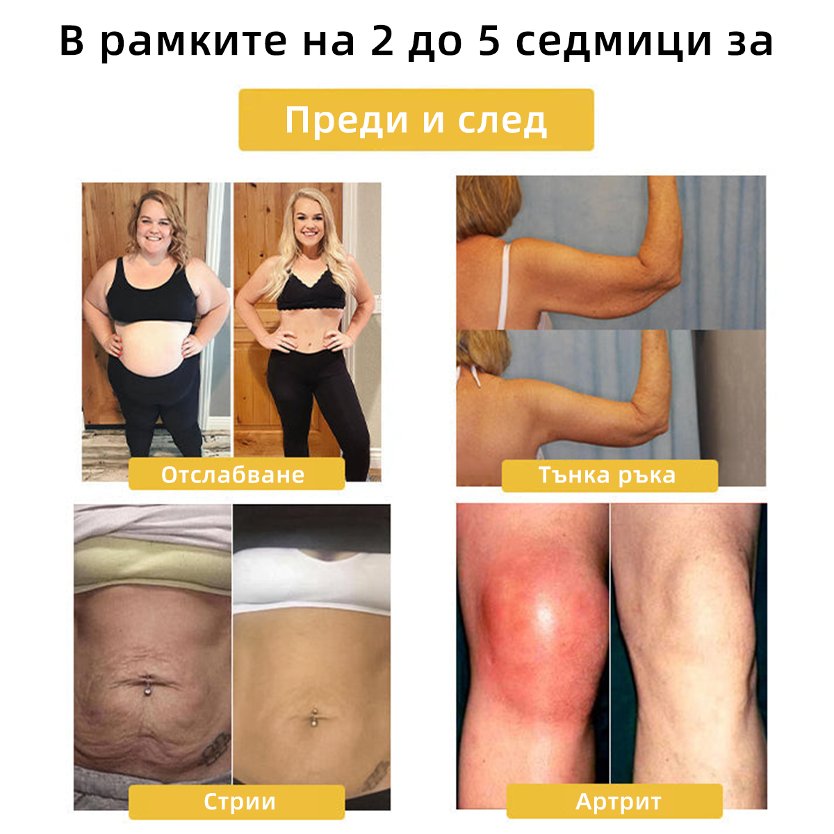 Последни дни на супер намаление, ексклузивна оферта от 80%! 🎁 - CZTICLE™ Магнитен терапевтичен пръстен за лимфен дренаж с котешко око 🔥🌸