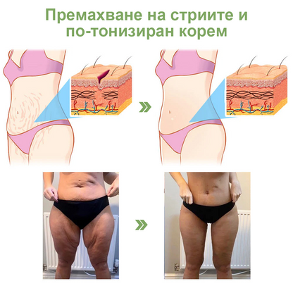 STDEI™ Луксозен Колагенов Стягащ Крем (🔥74% отстъпка за ограничено време!) 💥