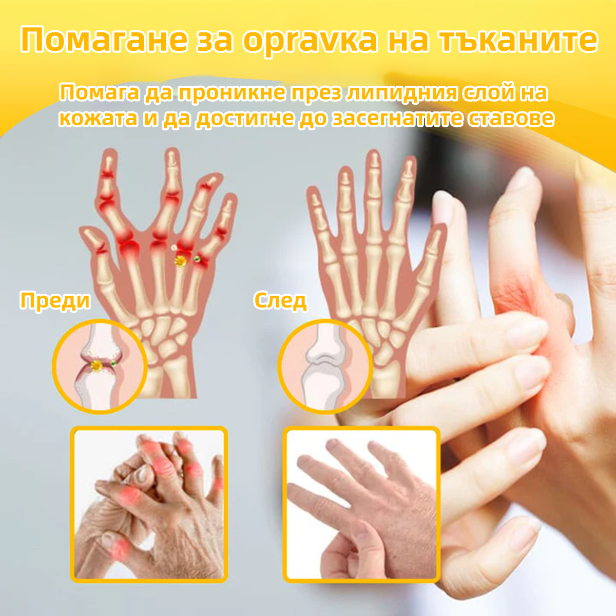 𝑭𝑨𝑻𝑶𝑵𝑮® Болкоуспокояващ лечебен крем за кости с пчелен феномен❤️‍🔥 (Специално за възрастни хора & 𝓡𝓞𝓙𝓞𝓢𝓣 препоръчва)🐝