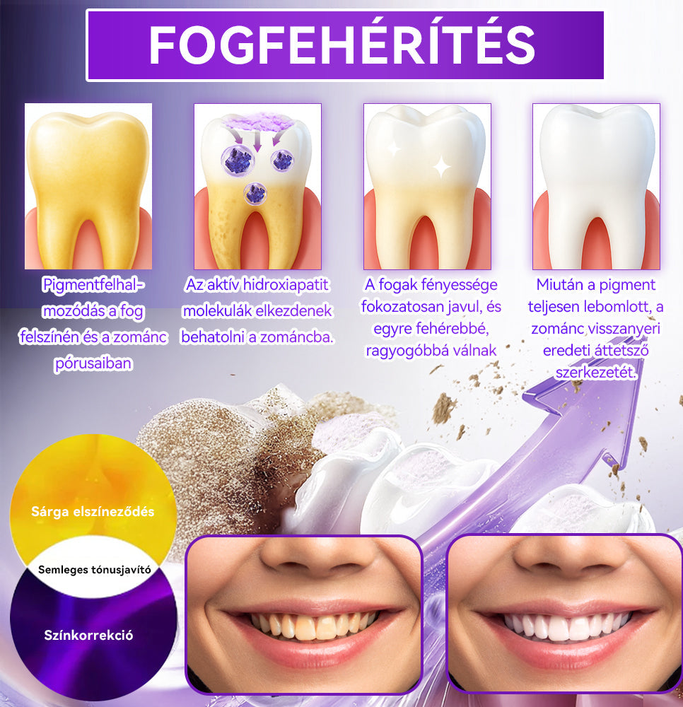 𝑫𝑜𝑟𝒎𝒐𝒓𝙣𝙖® Hidroxiapatit Foghelyreállitó Por👨‍⚕️Hatékonyan kezeli a szuvasodást, ínyproblémákat, érzékeny fogakat, szájüregi sebeket és sárga fogakat, miközben javítja az általános szájhigiéniát🎉