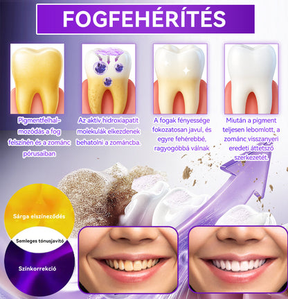 𝑫𝑜𝑟𝒎𝒐𝒓𝙣𝙖® Hidroxiapatit Foghelyreállitó Por👨‍⚕️Hatékonyan kezeli a szuvasodást, ínyproblémákat, érzékeny fogakat, szájüregi sebeket és sárga fogakat, miközben javítja az általános szájhigiéniát🎉