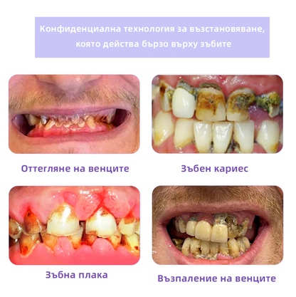 Oyikey™ Минерален прах за възстановяване на зъби🦷(BZS Препоръчано) ❤️‍🔥