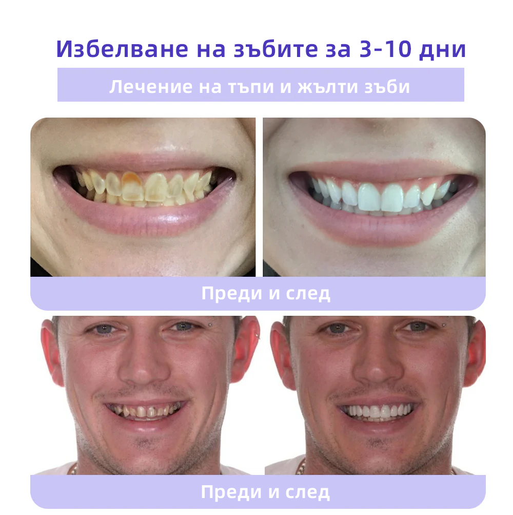 Oyikey™ Минерален прах за възстановяване на зъби🦷(BZS Препоръчано) ❤️‍🔥