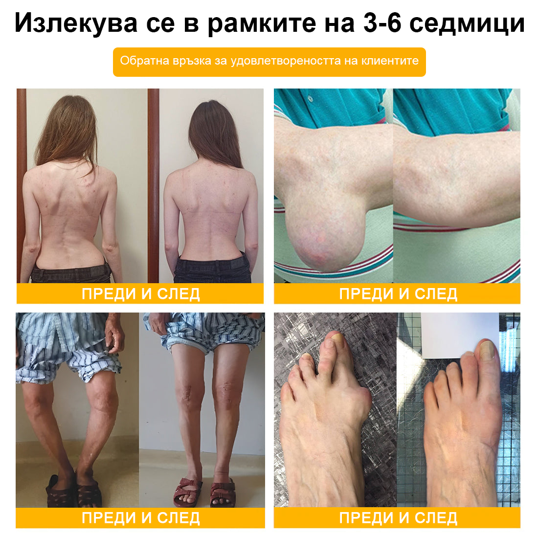 FATONG™ Крем за облекчаване на болката в костите с пчелна отрова (Специално за възрастни хора, препоръчван от Американската академия по ортопедична хирургия - AAOS)