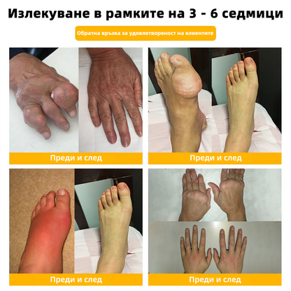 𝑭𝑨𝑻𝑶𝑵𝑮® Болкоуспокояващ лечебен крем за кости с пчелен феномен❤️‍🔥 (Специално за възрастни хора & 𝓡𝓞𝓙𝓞𝓢𝓣 препоръчва)🐝