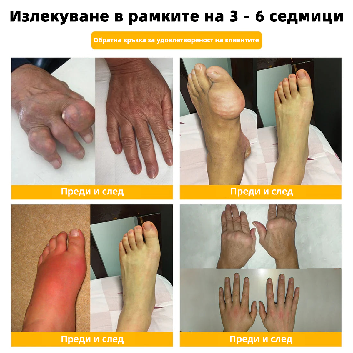 𝑭𝑨𝑻𝑶𝑵𝑮® Болкоуспокояващ лечебен крем за кости с пчелен феномен🐝 (Специално за възрастни хора & ROJOST препоръчва)🔥🔥
