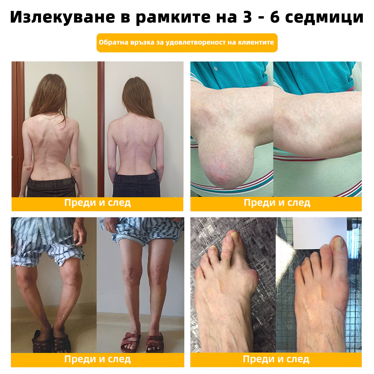 𝑭𝑨𝑻𝑶𝑵𝑮® Болкоуспокояващ лечебен крем за кости с пчелен феномен❤️‍🔥 (Специално за възрастни хора & 𝓡𝓞𝓙𝓞𝓢𝓣 препоръчва)🐝
