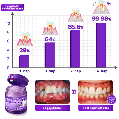𝑫𝑜𝑟𝒎𝒐𝒓𝙣𝙖® Hidroxiapatit Foghelyreállitó Por👨‍⚕️Hatékonyan kezeli a szuvasodást, ínyproblémákat, érzékeny fogakat, szájüregi sebeket és sárga fogakat, miközben javítja az általános szájhigiéniát🎉