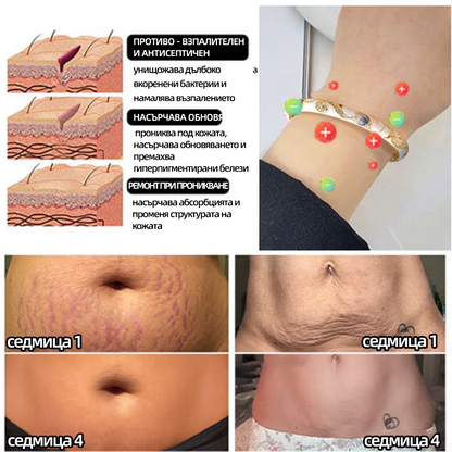 𝐂𝐙𝐓𝐈𝐂𝐋𝐄™Златен браслет с клуазонева емаль👩‍⚕️ Магнитна лимфатна терапия🌺