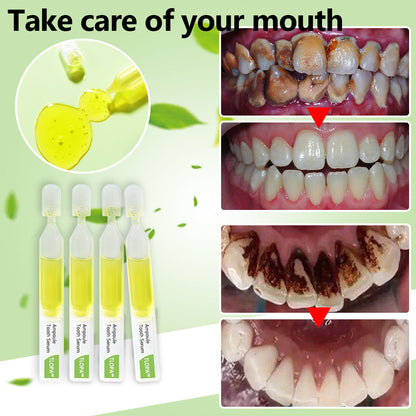 💎TLOPA™ Ampoule Toothpaste(for all kinds of dental problems, including cosmetic and rejuvenation)