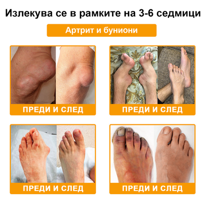 FATONG™ Крем за облекчаване на болката в костите с пчелна отрова (Специално за възрастни хора, препоръчван от Американската академия по ортопедична хирургия - AAOS)