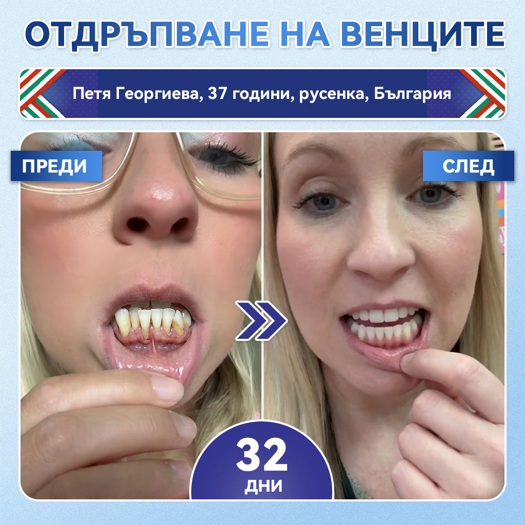 🦷𝑮𝒍𝒊𝒎𝒎𝒆𝒓𝒍𝒚® 𝑻𝑰𝑫𝑬𝑮𝑳𝑼𝑺𝑰𝑩 𝑻𝑰𝑫𝑬𝑮𝑳𝑼𝑺𝑰𝑩 ЗЪБИИ ВЕНЦИ Ремонт на пластир с микроигли | 👩‍⚕️( Възстановяване на емайла и дентина • Укрепване на венците • Премахване на зъбен камък и лош дъх • Прекратяване на чувствителността на зъбите)3.0❤️