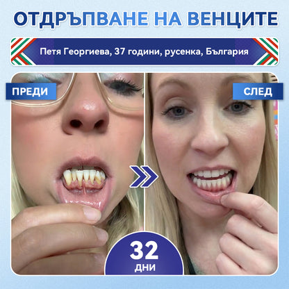 🦷𝑮𝒍𝒊𝒎𝒎𝒆𝒓𝒍𝒚® 𝑻𝑰𝑫𝑬𝑮𝑳𝑼𝑺𝑰𝑩 𝑻𝑰𝑫𝑬𝑮𝑳𝑼𝑺𝑰𝑩 ЗЪБИИ ВЕНЦИ Ремонт на пластир с микроигли | 👩‍⚕️( Възстановяване на емайла и дентина • Укрепване на венците • Премахване на зъбен камък и лош дъх • Прекратяване на чувствителността на зъбите)3.0❤️