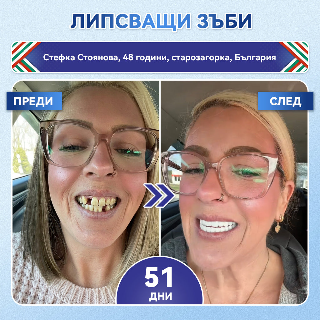 🦷𝑮𝒍𝒊𝒎𝒎𝒆𝒓𝒍𝒚® 𝑻𝑰𝑫𝑬𝑮𝑳𝑼𝑺𝑰𝑩 𝑻𝑰𝑫𝑬𝑮𝑳𝑼𝑺𝑰𝑩 ЗЪБИИ ВЕНЦИ Ремонт на пластир с микроигли | 👩‍⚕️( Възстановяване на емайла и дентина • Укрепване на венците • Премахване на зъбен камък и лош дъх • Прекратяване на чувствителността на зъбите)3.0❤️
