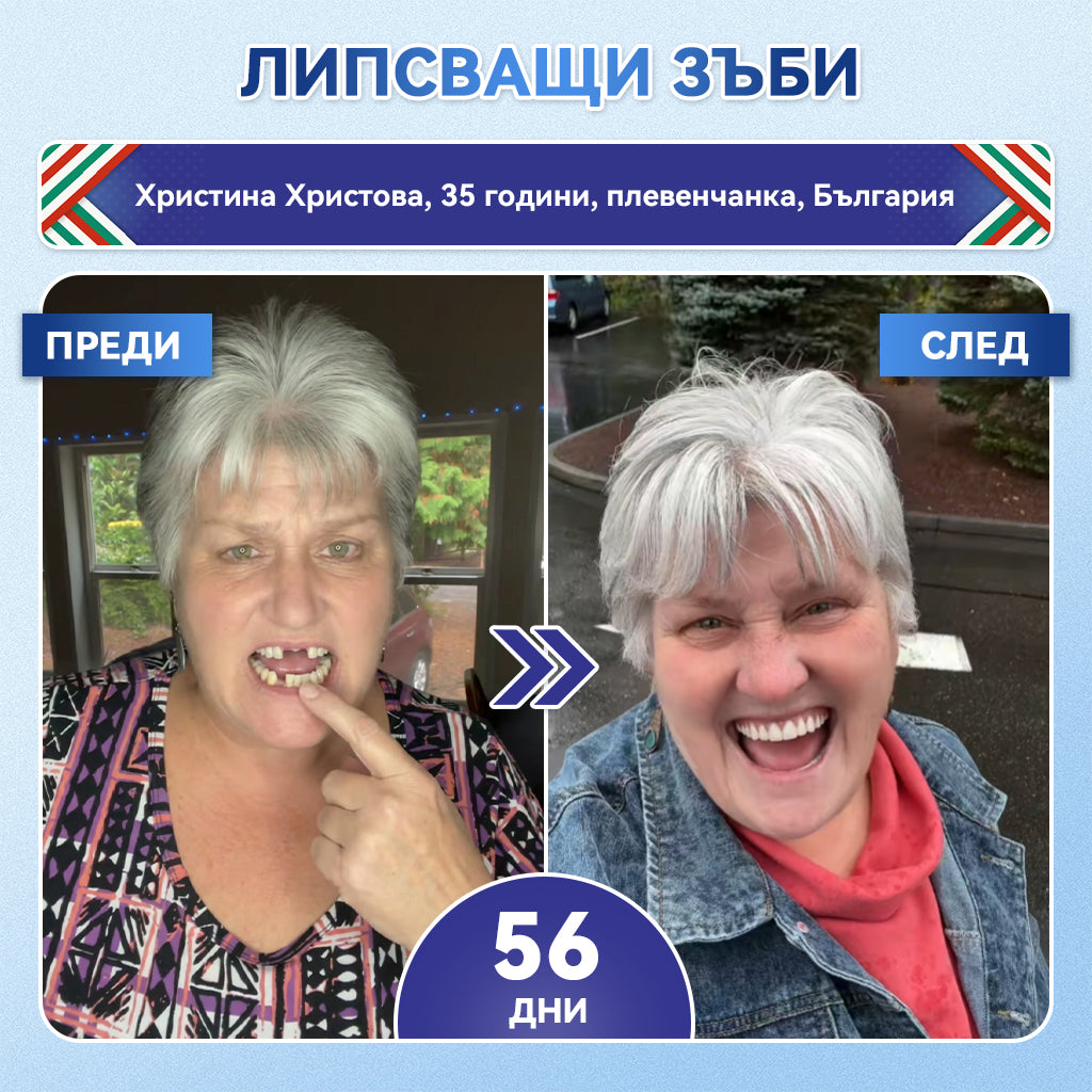 🦷𝑮𝒍𝒊𝒎𝒎𝒆𝒓𝒍𝒚® 𝑻𝑰𝑫𝑬𝑮𝑳𝑼𝑺𝑰𝑩 𝑻𝑰𝑫𝑬𝑮𝑳𝑼𝑺𝑰𝑩 ЗЪБИИ ВЕНЦИ Ремонт на пластир с микроигли | 👩‍⚕️( Възстановяване на емайла и дентина • Укрепване на венците • Премахване на зъбен камък и лош дъх • Прекратяване на чувствителността на зъбите)3.0❤️