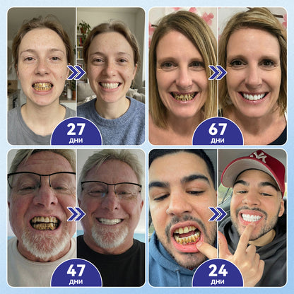 🦷𝑮𝒍𝒊𝒎𝒎𝒆𝒓𝒍𝒚® 𝑻𝑰𝑫𝑬𝑮𝑳𝑼𝑺𝑰𝑩 𝑻𝑰𝑫𝑬𝑮𝑳𝑼𝑺𝑰𝑩 ЗЪБИИ ВЕНЦИ Ремонт на пластир с микроигли | 👩‍⚕️( Възстановяване на емайла и дентина • Укрепване на венците • Премахване на зъбен камък и лош дъх • Прекратяване на чувствителността на зъбите)3.0❤️