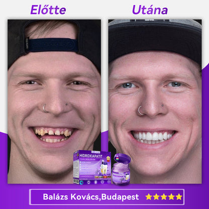 𝑫𝑜𝑟𝒎𝒐𝒓𝙣𝙖® Hidroxiapatit Foghelyreállitó Por👨‍⚕️Hatékonyan kezeli a szuvasodást, ínyproblémákat, érzékeny fogakat, szájüregi sebeket és sárga fogakat, miközben javítja az általános szájhigiéniát🎉