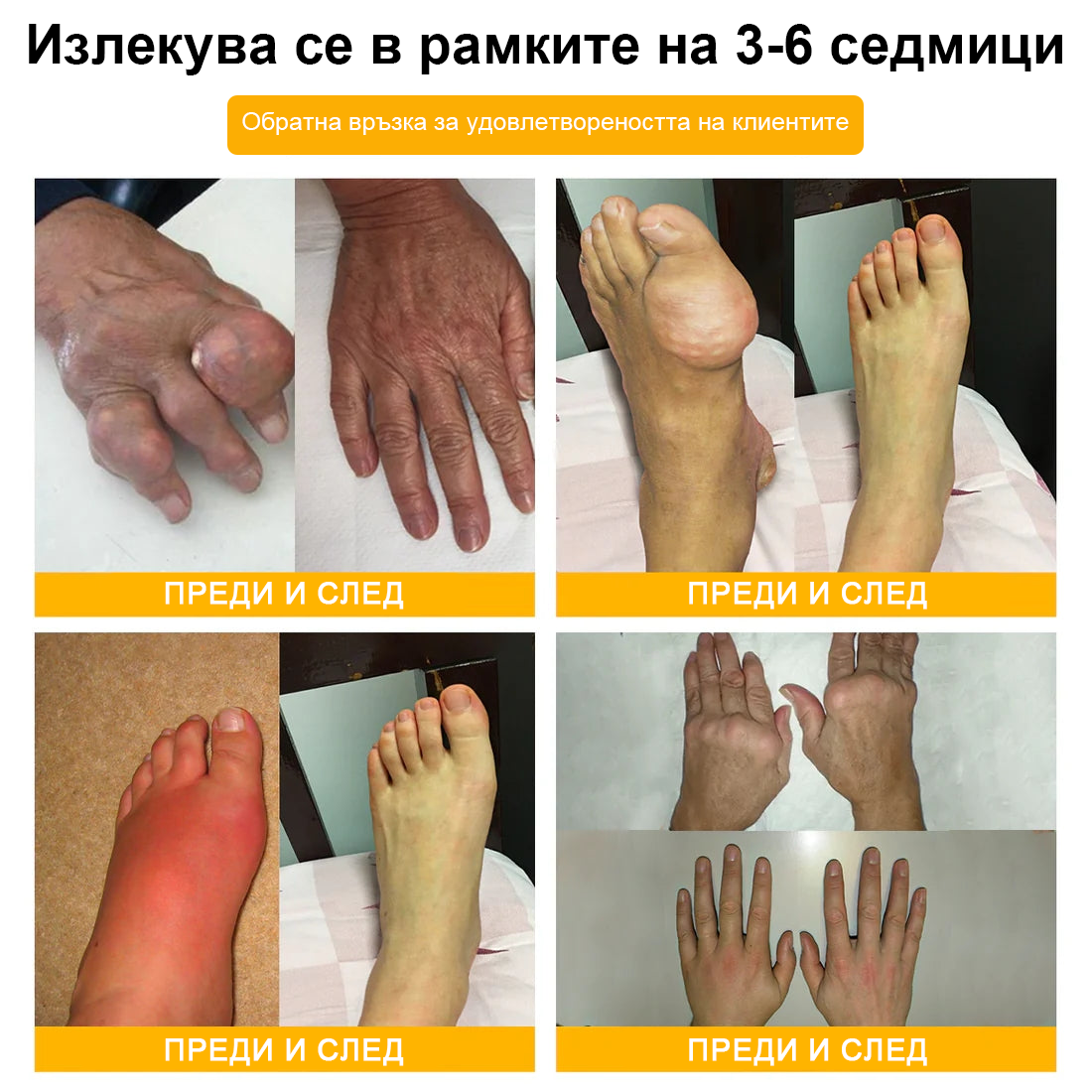 FATONG™ Крем за облекчаване на болката в костите с пчелна отрова (Специално за възрастни хора, препоръчван от Американската академия по ортопедична хирургия - AAOS)