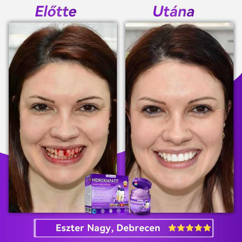 𝑫𝑜𝑟𝒎𝒐𝒓𝙣𝙖® Hidroxiapatit Foghelyreállitó Por👨‍⚕️Hatékonyan kezeli a szuvasodást, ínyproblémákat, érzékeny fogakat, szájüregi sebeket és sárga fogakat, miközben javítja az általános szájhigiéniát🎉