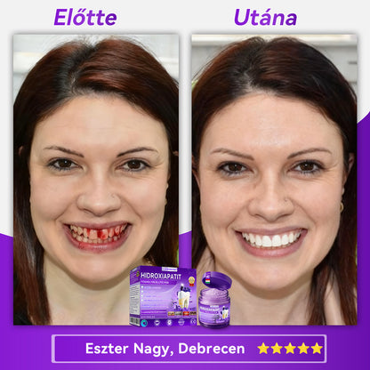 𝑫𝑜𝑟𝒎𝒐𝒓𝙣𝙖® Hidroxiapatit Foghelyreállitó Por👨‍⚕️Hatékonyan kezeli a szuvasodást, ínyproblémákat, érzékeny fogakat, szájüregi sebeket és sárga fogakat, miközben javítja az általános szájhigiéniát🎉