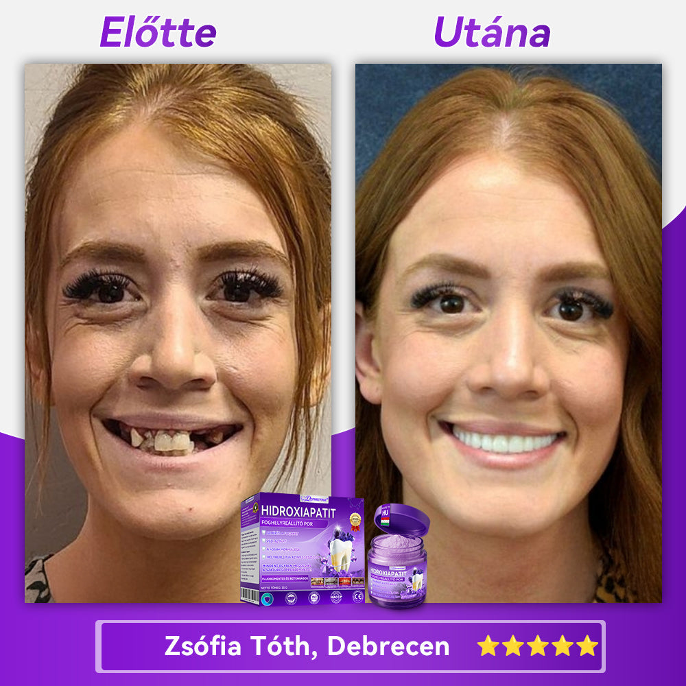 𝑫𝑜𝑟𝒎𝒐𝒓𝙣𝙖® Hidroxiapatit Foghelyreállitó Por👨‍⚕️Hatékonyan kezeli a szuvasodást, ínyproblémákat, érzékeny fogakat, szájüregi sebeket és sárga fogakat, miközben javítja az általános szájhigiéniát🎉