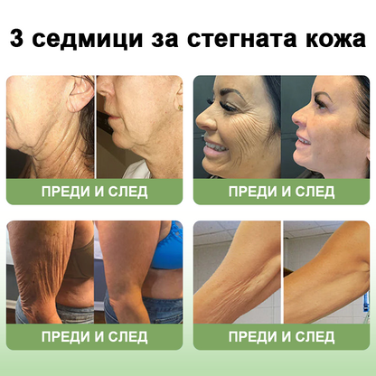 STDEI™ Луксозен Колагенов Стягащ Крем (🔥74% отстъпка за ограничено време!) 💥