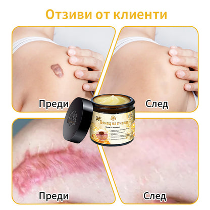 𝑇𝑢𝑟𝑜𝑛𝑢™ Крем за грижа за кожата на основата на пчелна отрова🐝 (Препоръчано от NCPH)💎