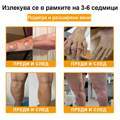 FATONG™ Крем за облекчаване на болката в костите с пчелна отрова (Специално за възрастни хора, препоръчван от Американската академия по ортопедична хирургия - AAOS)