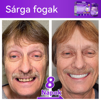 𝑫𝑜𝑟𝒎𝒐𝒓𝙣𝙖® Hidroxiapatit Foghelyreállitó Por👨‍⚕️Hatékonyan kezeli a szuvasodást, ínyproblémákat, érzékeny fogakat, szájüregi sebeket és sárga fogakat, miközben javítja az általános szájhigiéniát🎉