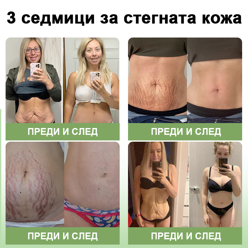 STDEI™ Луксозен Колагенов Стягащ Крем (🔥74% отстъпка за ограничено време!) 💥