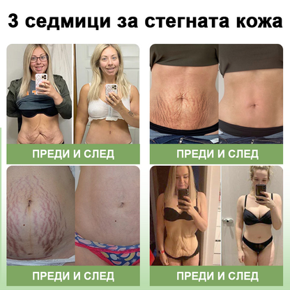 STDEI™ Луксозен Колагенов Стягащ Крем (🔥74% отстъпка за ограничено време!) 💥