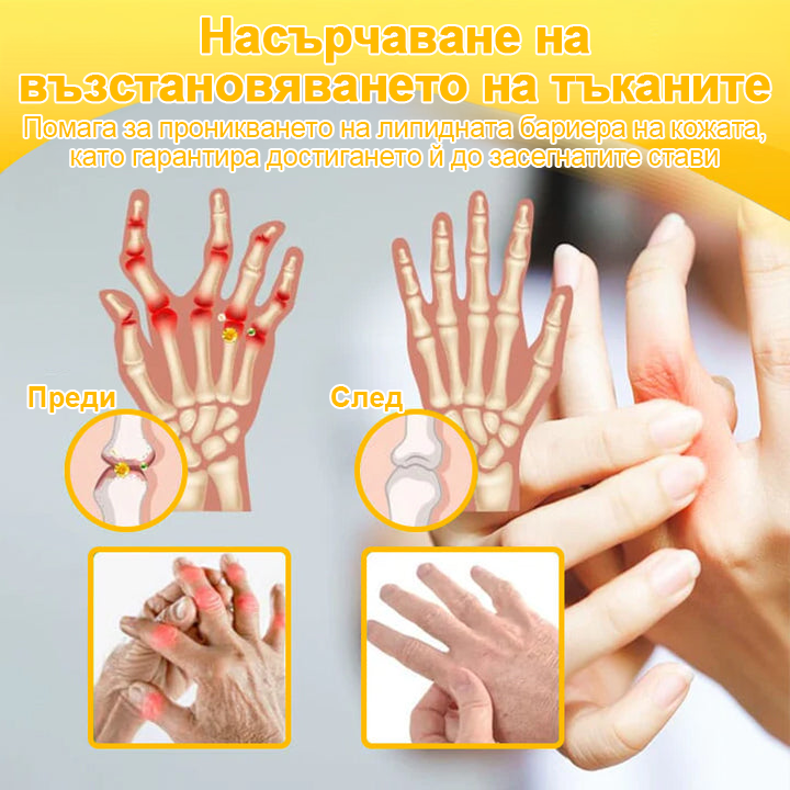 FATONG™ Крем за облекчаване на болката в костите с пчелна отрова (Специално за възрастни хора, препоръчван от Американската академия по ортопедична хирургия - AAOS)