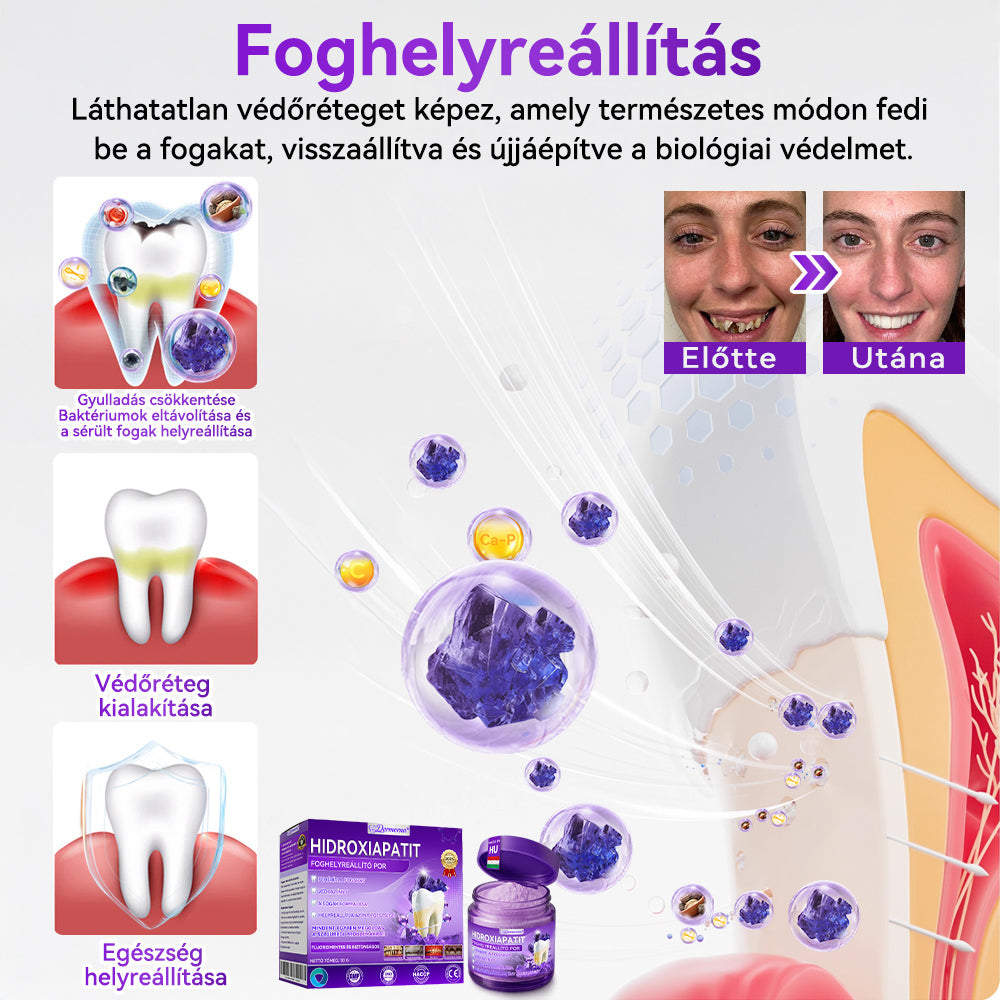 𝑫𝑜𝑟𝒎𝒐𝒓𝙣𝙖® Hidroxiapatit Foghelyreállitó Por👨‍⚕️Hatékonyan kezeli a szuvasodást, ínyproblémákat, érzékeny fogakat, szájüregi sebeket és sárga fogakat, miközben javítja az általános szájhigiéniát🎉