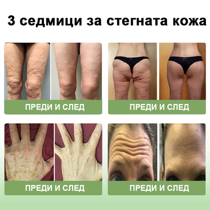 STDEI™ Луксозен Колагенов Стягащ Крем (🔥74% отстъпка за ограничено време!) 💥