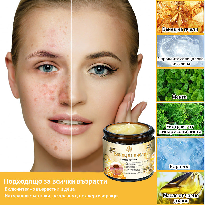 𝑇𝑢𝑟𝑜𝑛𝑢™ Крем за грижа за кожата на основата на пчелна отрова🐝 (Препоръчано от NCPH)💎