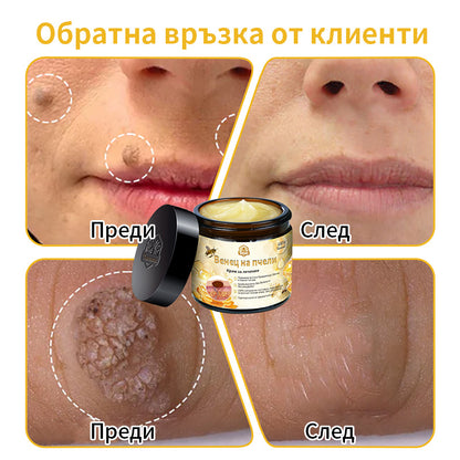 𝑇𝑢𝑟𝑜𝑛𝑢™ Крем за грижа за кожата на основата на пчелна отрова🐝 (Препоръчано от NCPH)💎